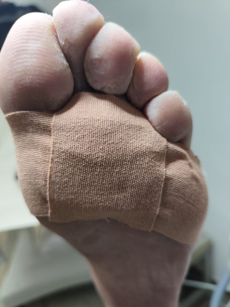 Profesionalni završetak: zaštitni zavoj sa kineziološkim tejpom